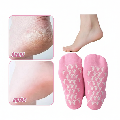 Avant après chaussette massage pied – talons secs et fissurés transformés en peau douce et lisse